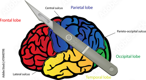 Brain Surgery