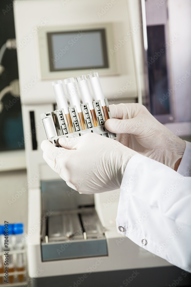 Researcher Analyzing Urine Samples In Laboratory