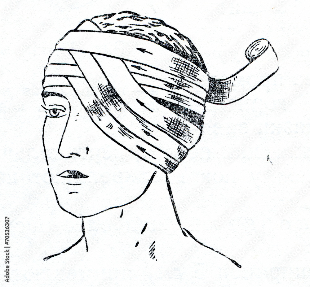 Bandaging one eye Stock Illustration Adobe Stock