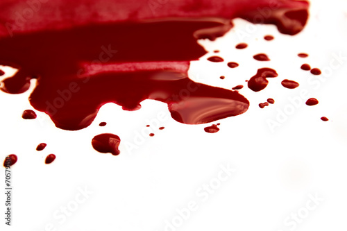 Blood pool (puddle)
