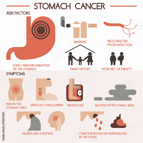 Stomach cancer vector eps 10