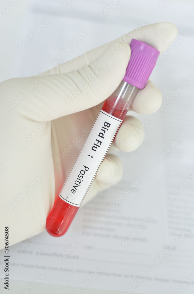 Obraz premium Bird Flu positive