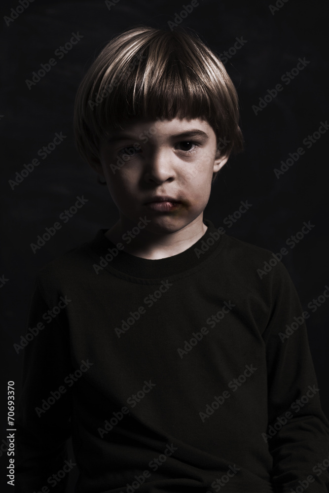 Fototapeta premium Little boy adly beaten up, with wounds on his face