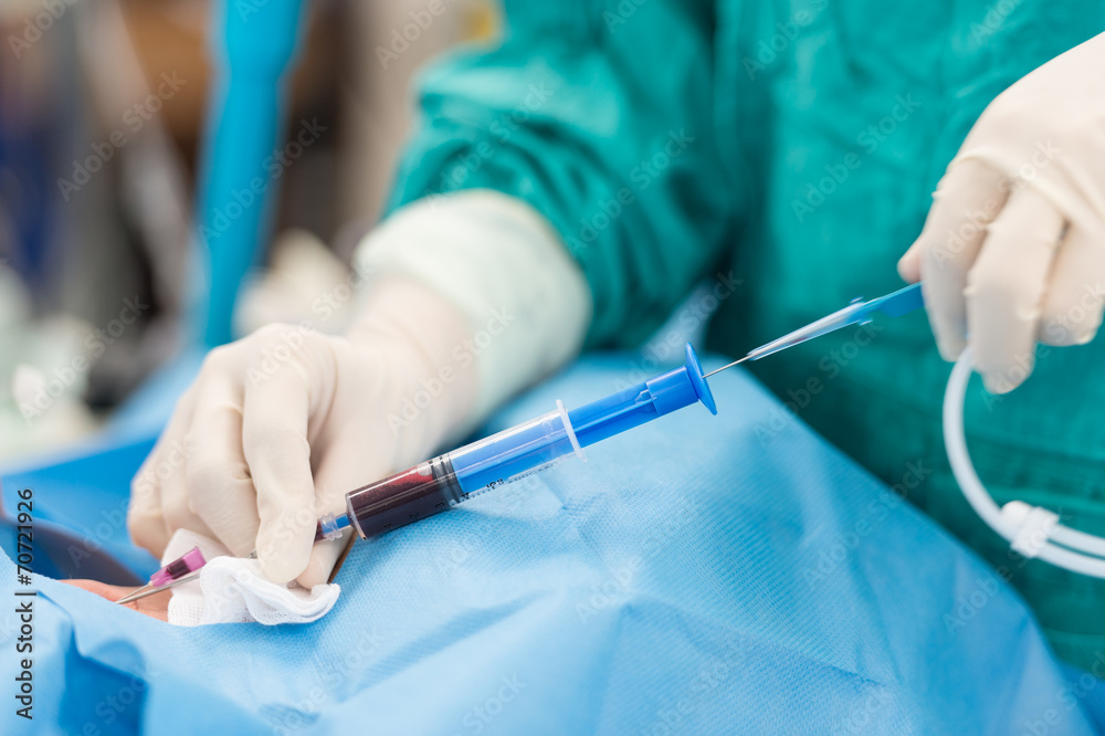 apply guide wire in internal carotid vein apply guide wire in internal carotid vein