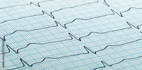 cardiogram of heart beat photo