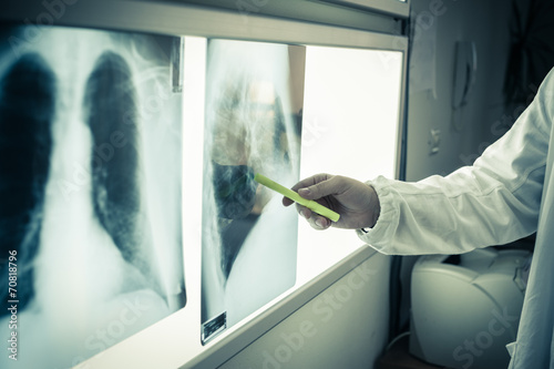 Tableau sur toile Radiography