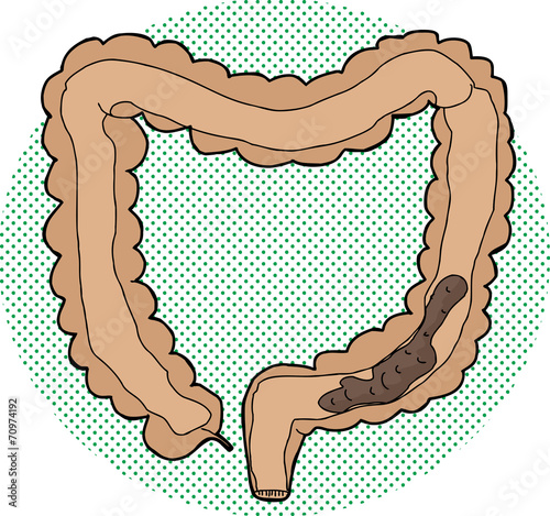 Bowel in Large Intestine