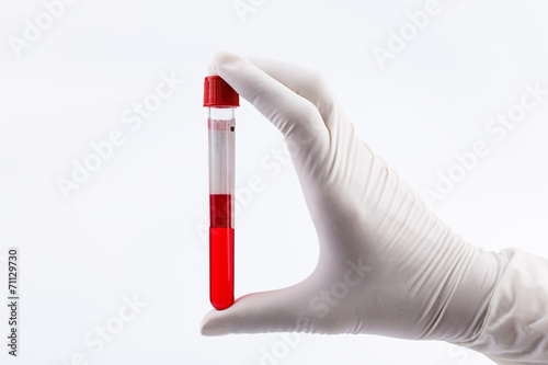 Hand holding test tube with blood plasma ready for testing