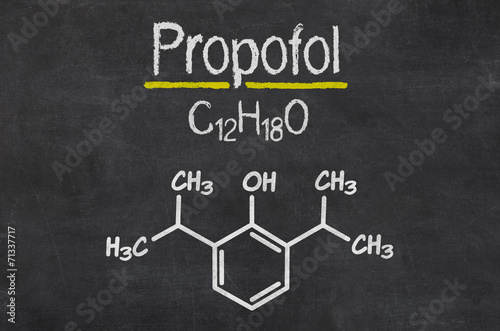 Schiefertafel mit der chemischen Formel von Propofol