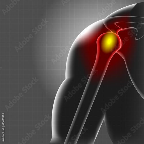 Shoulder pain