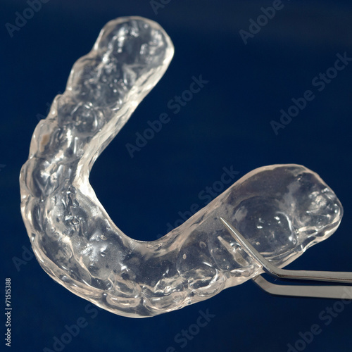 Dental splint photo