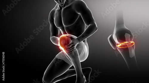 Injured knee concept