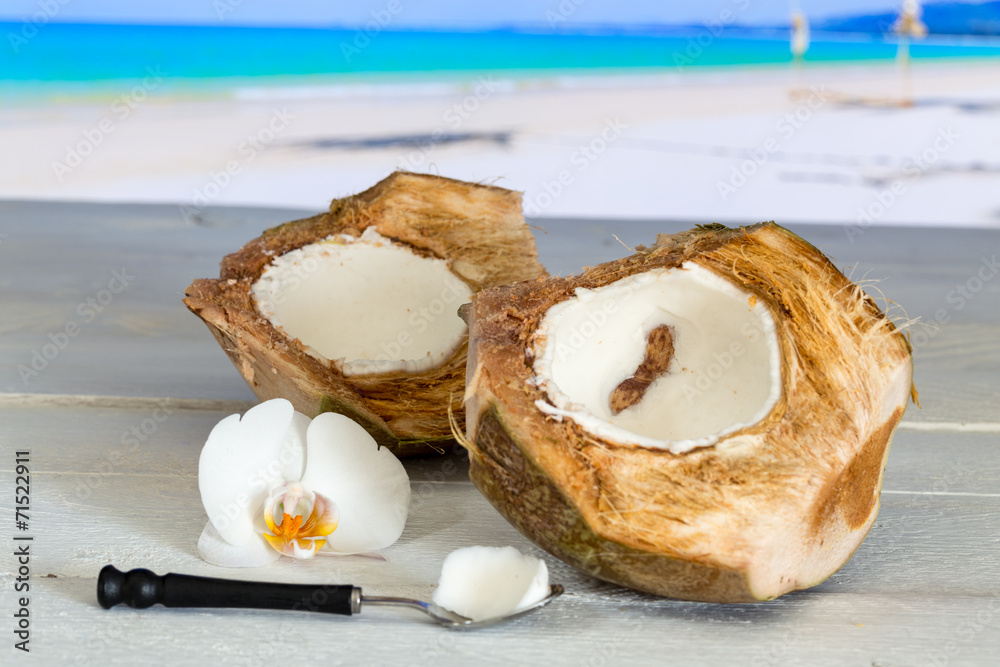 Kokosnuss am Strand mit Löffel und Orchidee