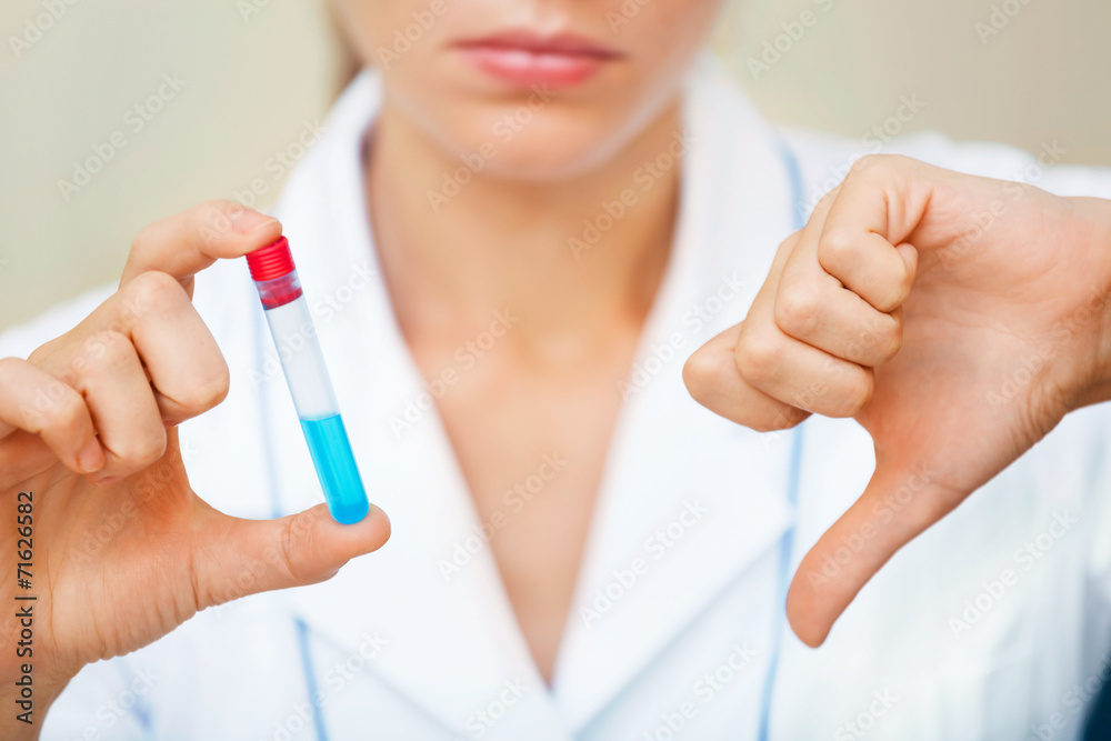 Unhappy young scientist holding samples with bad testing results Unhappy young scientist holding samples with bad testing results