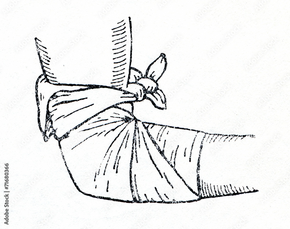 Triangular bandage applied to elbow Stock Photo Adobe Stock