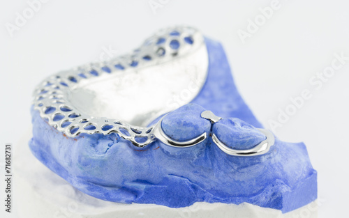 Dental wire bending for make a partial denture photo