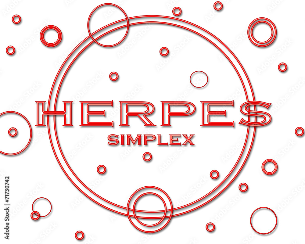 Fototapeta premium Herpes Simplex