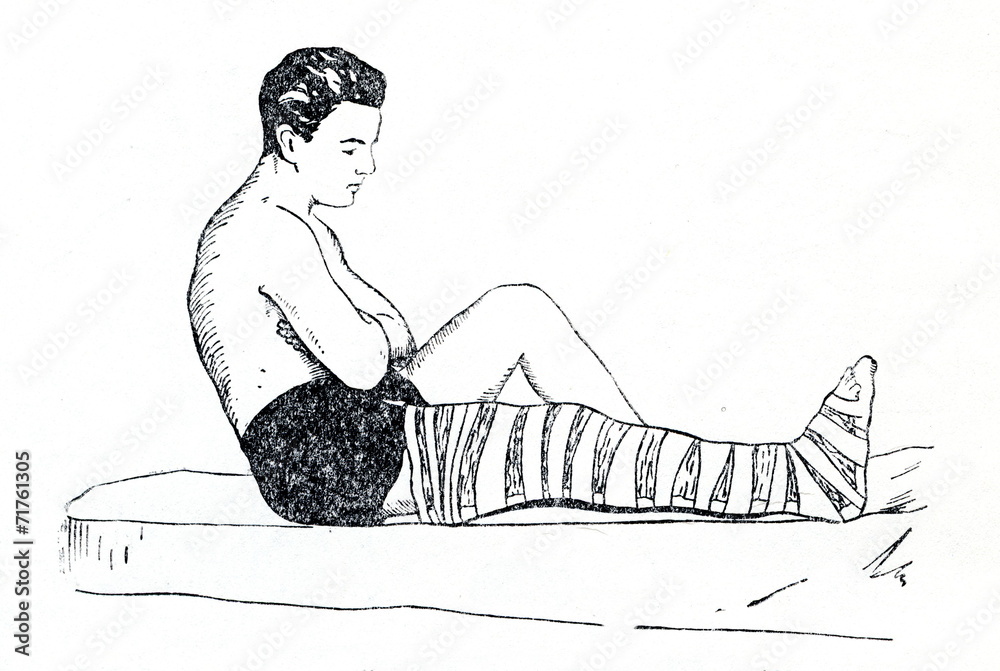 Splinter Injury Leg Emergency splinting of leg fracture Stock Photo | Adobe Stock