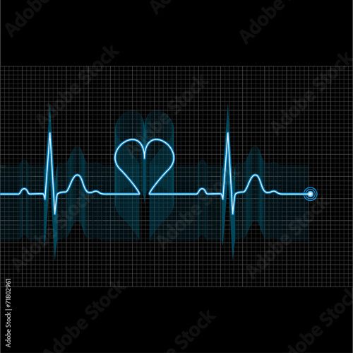 Illustration of medical electrocardiogram - ECG