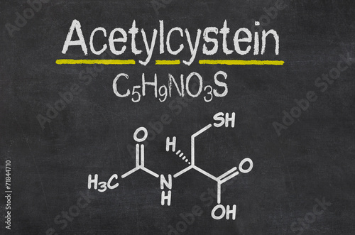 Schiefertafel mit der chemischen Formel von Acetylcystein