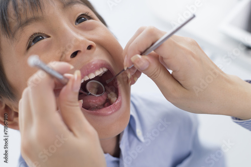 Boy undergoing dental caries check by opening the big mouth photo