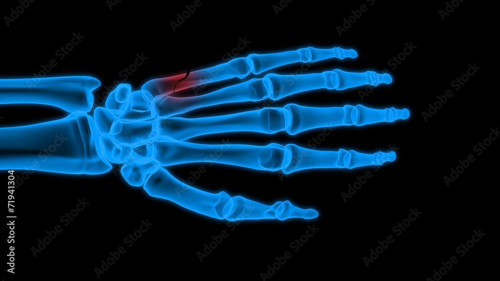 X-ray hand X-ray hand