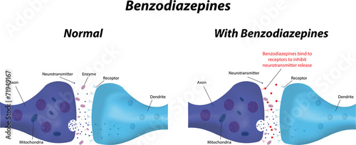 Benzodiazepines