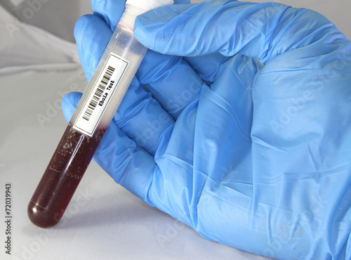 Ebola blood test tube in a medical laboratory