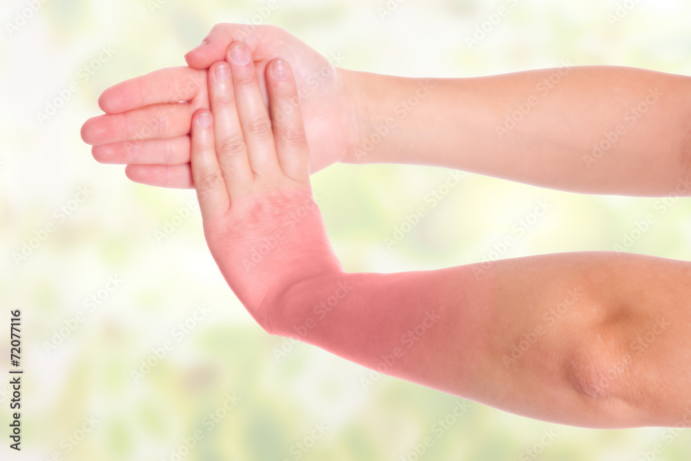Handgelenk Schmerzen , farbige Darstellung Handgelenk Schmerzen , farbige Darstellung