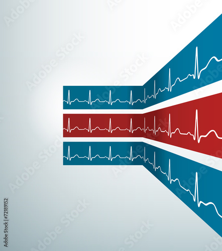 Abstract vector stripes with heartbeat line. Illustration