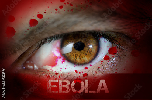 Ebola photo