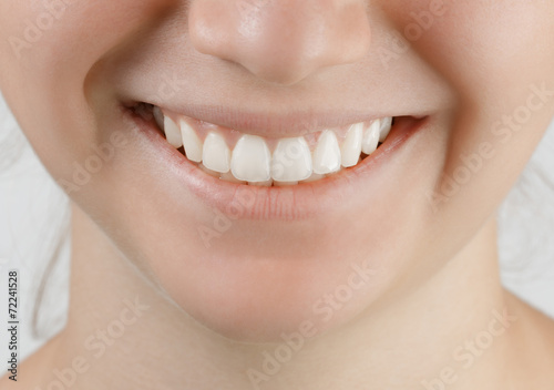teen smile with white perfect teeth
