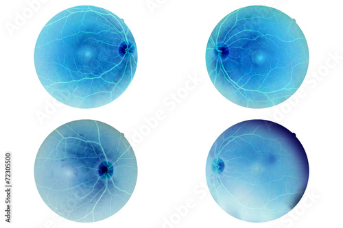 Human eye anatomy, retina, optic disc artery and vein etc.