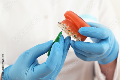 braces model with brush