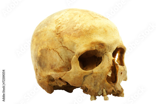 Genuine human skull isolated on white, lipids makes skull yellow