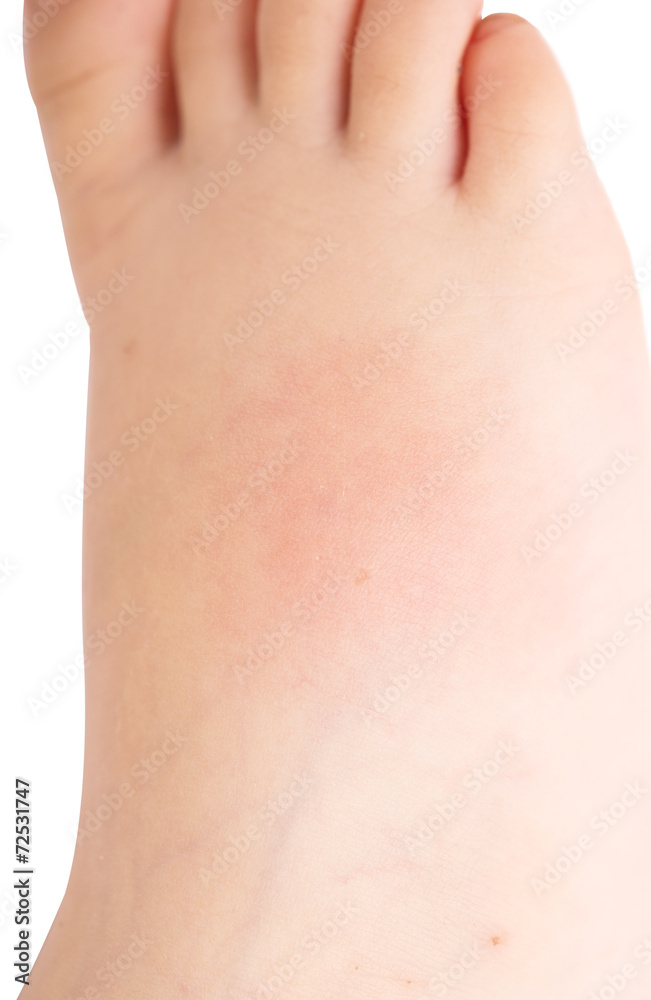 baby foot baby foot
