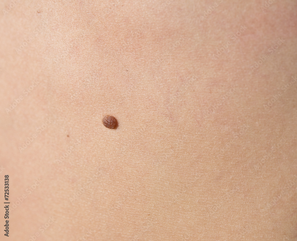 mole mole