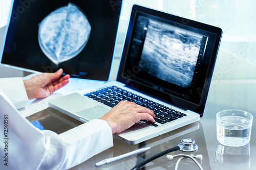 Doctor reviewing mammography results on pc. photo