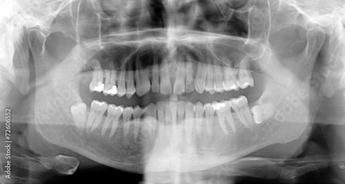 Radiografía Dental
