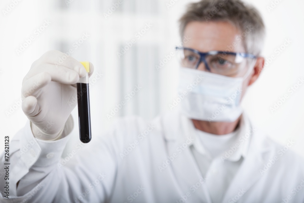 doctor looking on blood test tube doctor looking on blood test tube