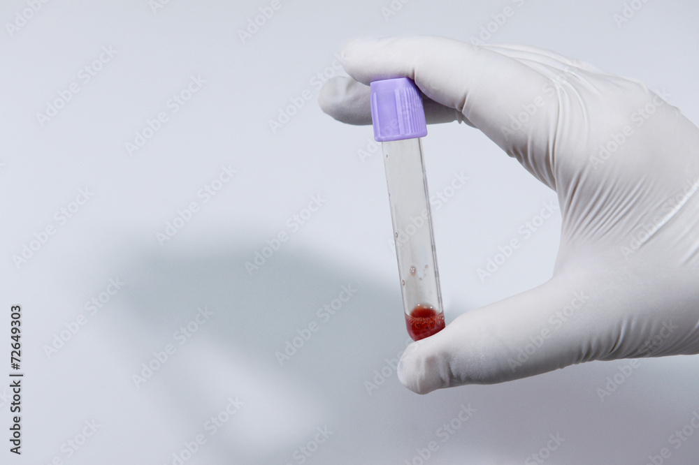 Blood test tube in a laboratory Blood test tube in a laboratory