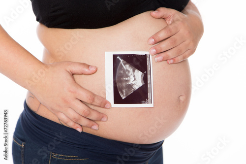 Ultraschallbild am Babybauch