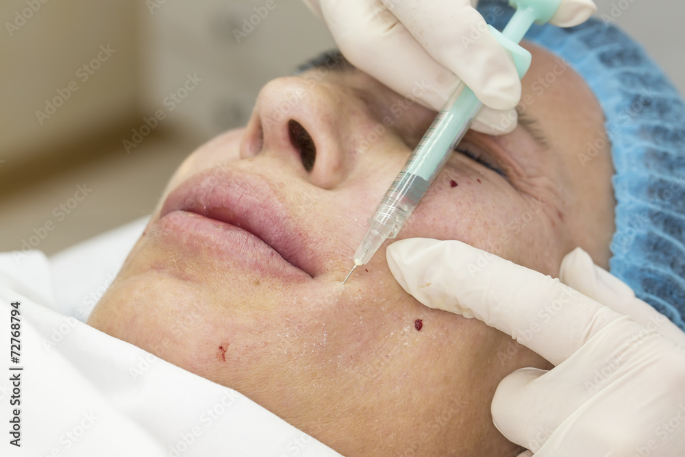 Cosmetic treatment with injection in a clinic Cosmetic treatment with injection in a clinic
