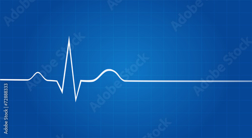 Blueprint Of Electrocardiogram Last Life Sign photo