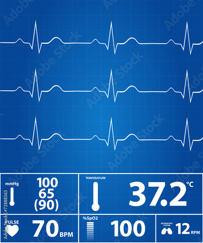 Blueprint Of Modern Electrocardiogram Monitor
