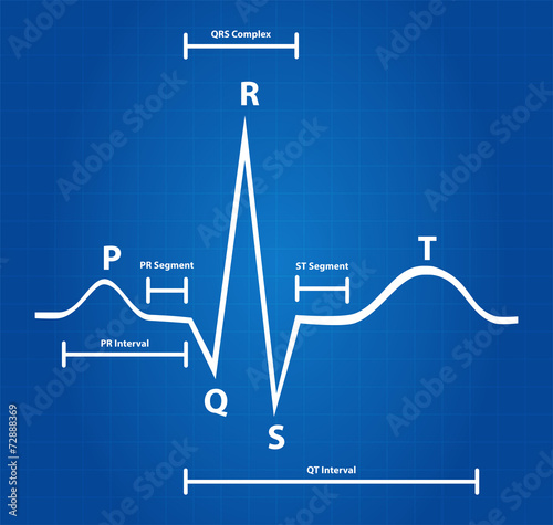 Blueprint Of Normal Electrocardiogram Graphic