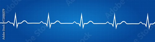Fotografia Blueprint Of Normal Electrocardiogram Graphic