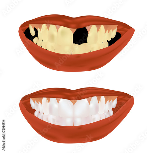 teeth