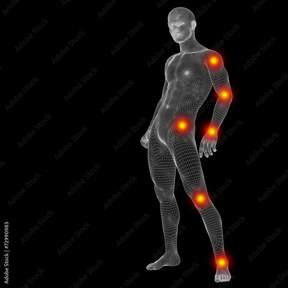 3D wireframe anatomy with pain 3D wireframe anatomy with pain