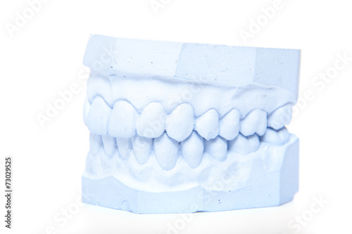Plaster cast of teeth. All on white background.